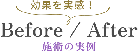 【Before / After】施術の実例